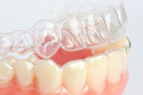 The image shows a set of clear aligners with teeth in them placed on a white surface.