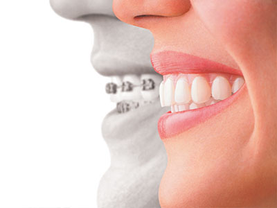 The image features a composite of two individuals  faces with a dental implant in between, highlighting the transformation from a natural tooth to an artificial one.