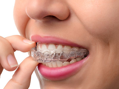 An adult female with clear braces, holding her finger under her chin, over a white background.