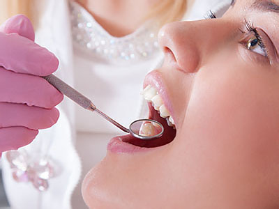 A dental professional performing a dental procedure on a patient s open mouth.